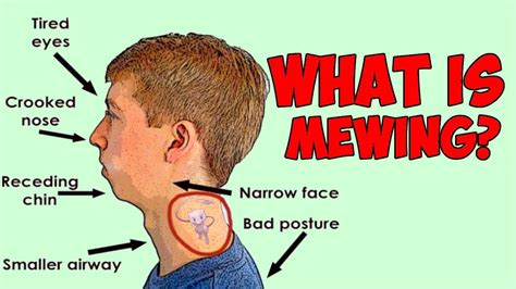 what is mewing and how to do it